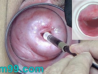 La cámara endoscopio japonés dentro del cuello uterino en icy vagina Cam