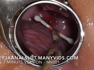Amateur FreyjaAnalslut : Removing the brush IUD - pulling it get off exposed to Freyja's Cervix, conclave the brush generative each time - Spry version exposed to ManyVids